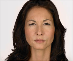 Angela 7 days after