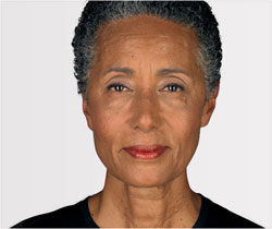 Pamela 7 days after